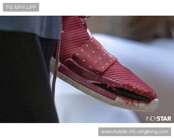 UFC传奇瞬间:天神一击后意外扭脚,震撼赛场背后的故事 UFC传奇瞬间:天神一击后意外扭脚,震撼赛场背后的故事